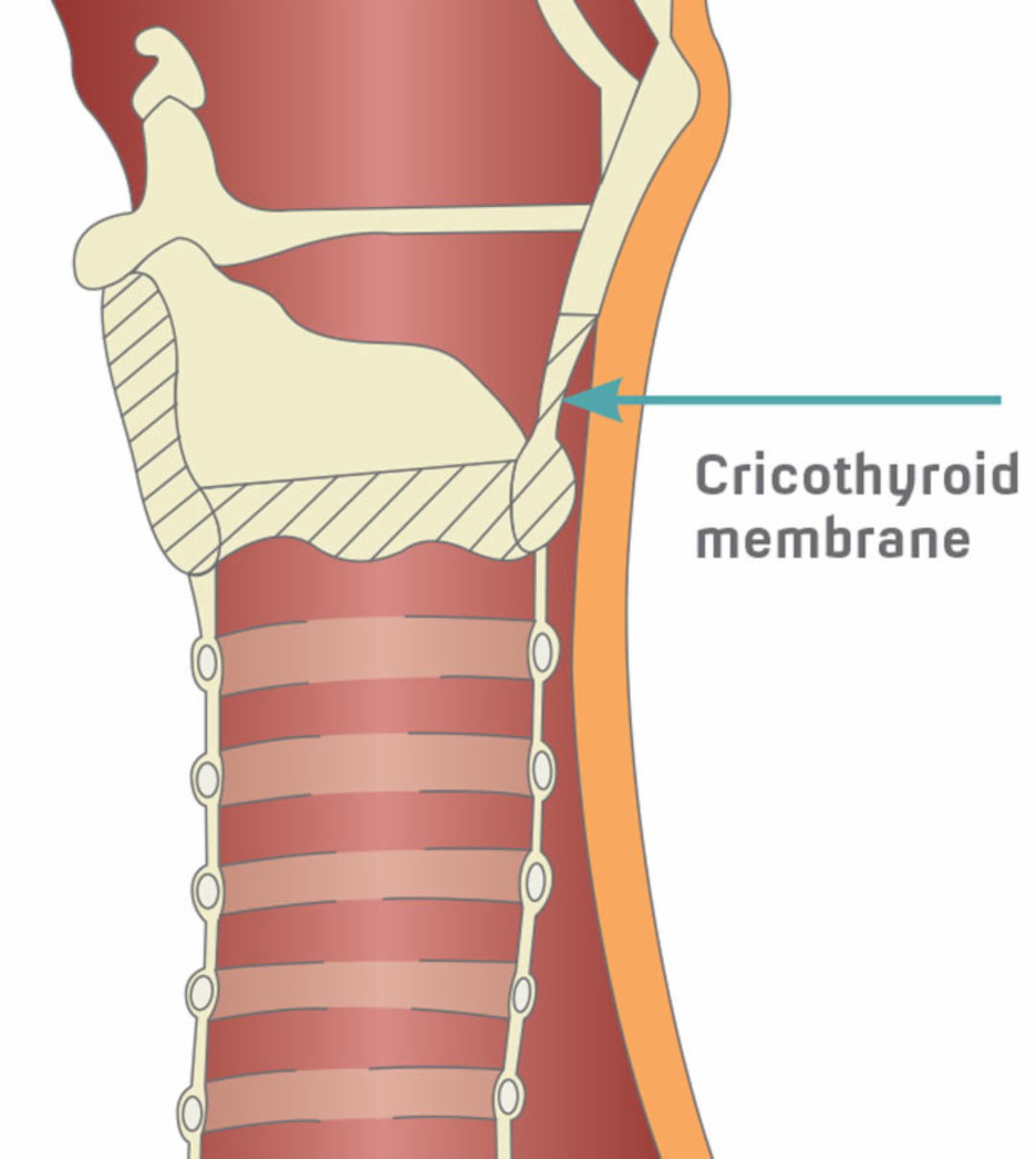image of diagram of cricothyroid membrane