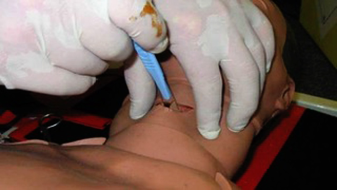 image of scalpel incising through cricothyroid membrane